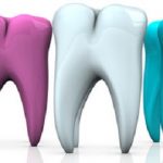 your Surrey emergency dentists suggests