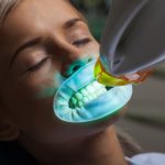 Teeth Whitening