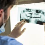 dental xrays