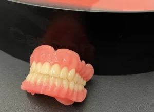 3d-printed-denture 3d-printed-denture